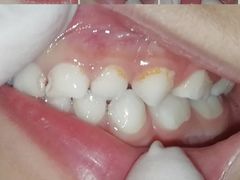 -极橙儿童齿科矫正中心(奥城店)