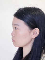 -深圳艺星医疗美容医院