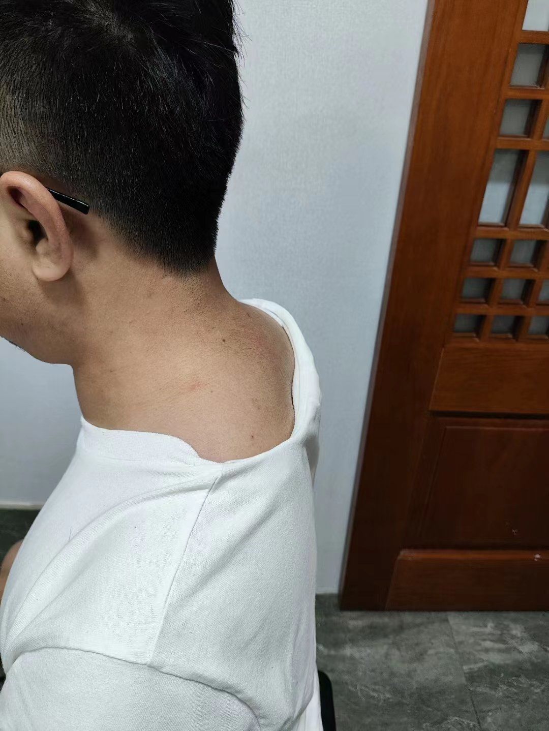 颈椎前倾正骨前后对比