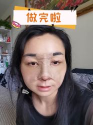 -素美医疗美容·西南眼鼻整形·修复基地