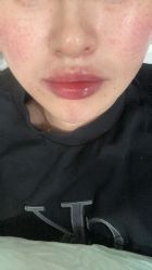 -上海漾颜医疗美容