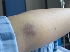 -重庆医科大学附属第一医院(本部)