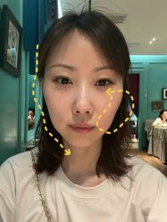 -天津伊美尔医疗整形美容专科医院