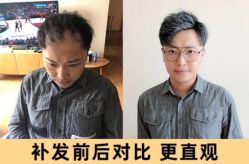 点击看大图 -极客侠男士假发定制补发