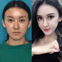 -上海时光整形外科医院
