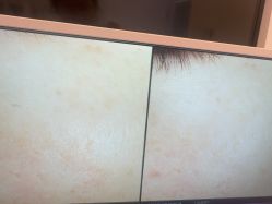 -苑苑vbeauty科技美容SPA