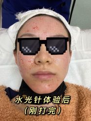 体验后-JS医疗美容