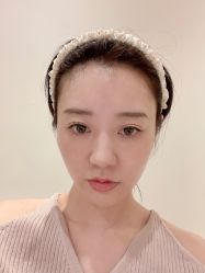 体验后-美莱医学美容医院