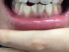 -微笑牙科口腔(三亚迎宾院区)