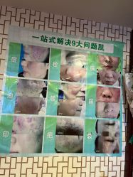-苗医生草本科技祛痘