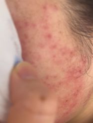 点击看大图 体验后-BR光电保养