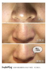 脸部抗衰-光SPA科技美肤