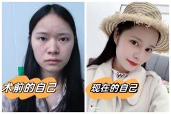 -素美医疗美容·西南眼鼻整形·修复基地