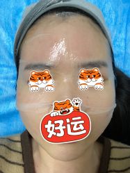 -圣嘉新医疗美容医院