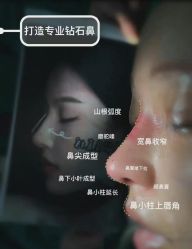 -北京米扬丽格医疗美容·联合丽格鼻整形中心