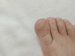 -新甲连锁灰指甲·甲沟炎·鸡眼(黑龙江路店)