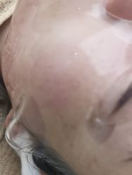 -宁波美莱整形美容