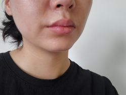 -洁铭新加坡医美