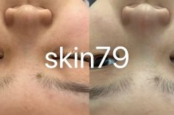 点击看大图 -SKIN79皮肤管理中心