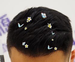 -大麦微针植发全国连锁