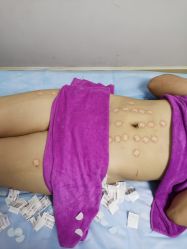 -清媚减肥瘦身纤体