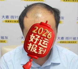 点击看大图 -大麦微针植发丨全国连锁