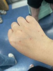 -清疣美疣·痣·斑净肤中心