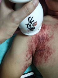 -久香宫美容中心西米优瘦身店