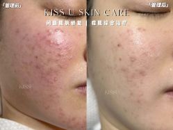 -KISS U 国际美学