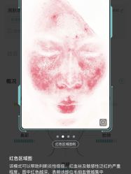点击看大图 体验前-SKINIST丽铂医疗美容