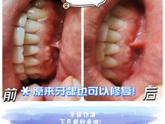 -修申骨雕小颜脊柱骨盆管理产后修复
