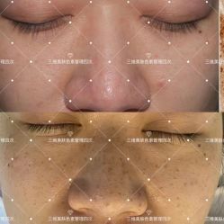 -Cream88颜皮肤管理中心