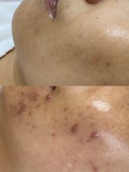 -康美贞·痘肌养护管理中心
