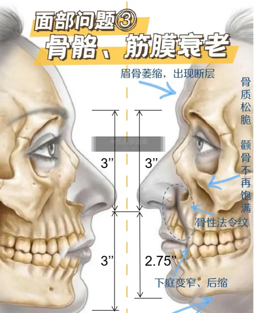 面部骨头名称图片图片