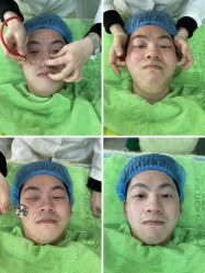 -清颜堂专业祛痘