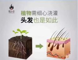 -顶尚堂白发脱发养发