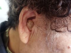 -自然之声助听器·呼吸机(公园路店)