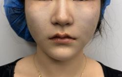 -天津健丽·去眼袋医疗美容机构