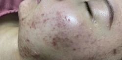 -康美贞·痘肌养护管理中心