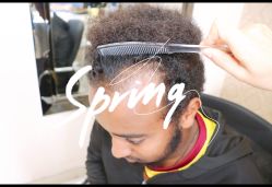 体验前-大麦微针植发全国连锁