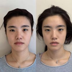 -颜和骨正·明哲式骨相美学整骨