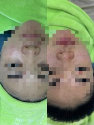 -苗医生0感祛痘连锁