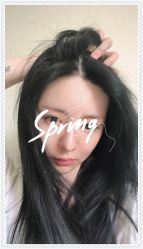 -大麦微针植发全国连锁