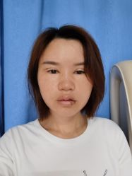 体验后-深圳美莱医疗美容医院