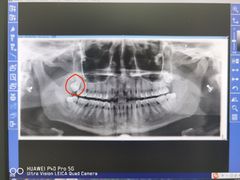 -上海市杨浦区牙病防治所