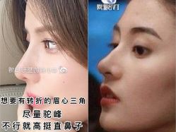 -八大处整形
