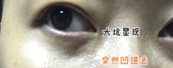 体验后-天津伊美尔医疗整形美容专科医院