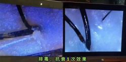 -希梵尔头皮抗衰·科技养发
