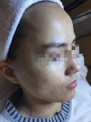 -皇族养心堂·净痘·修敏·御颜