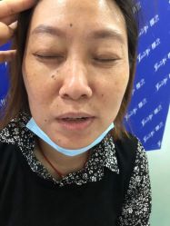 -郡艺医疗美容·微整·眼鼻吸脂